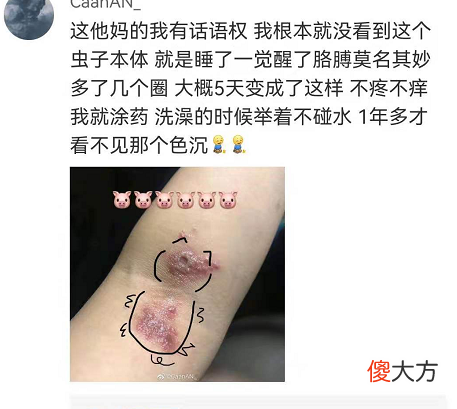 让多人皮肤溃烂 皮肤多处溃烂