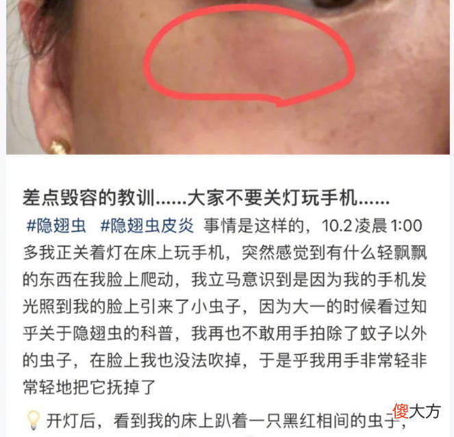 让多人皮肤溃烂 皮肤多处溃烂