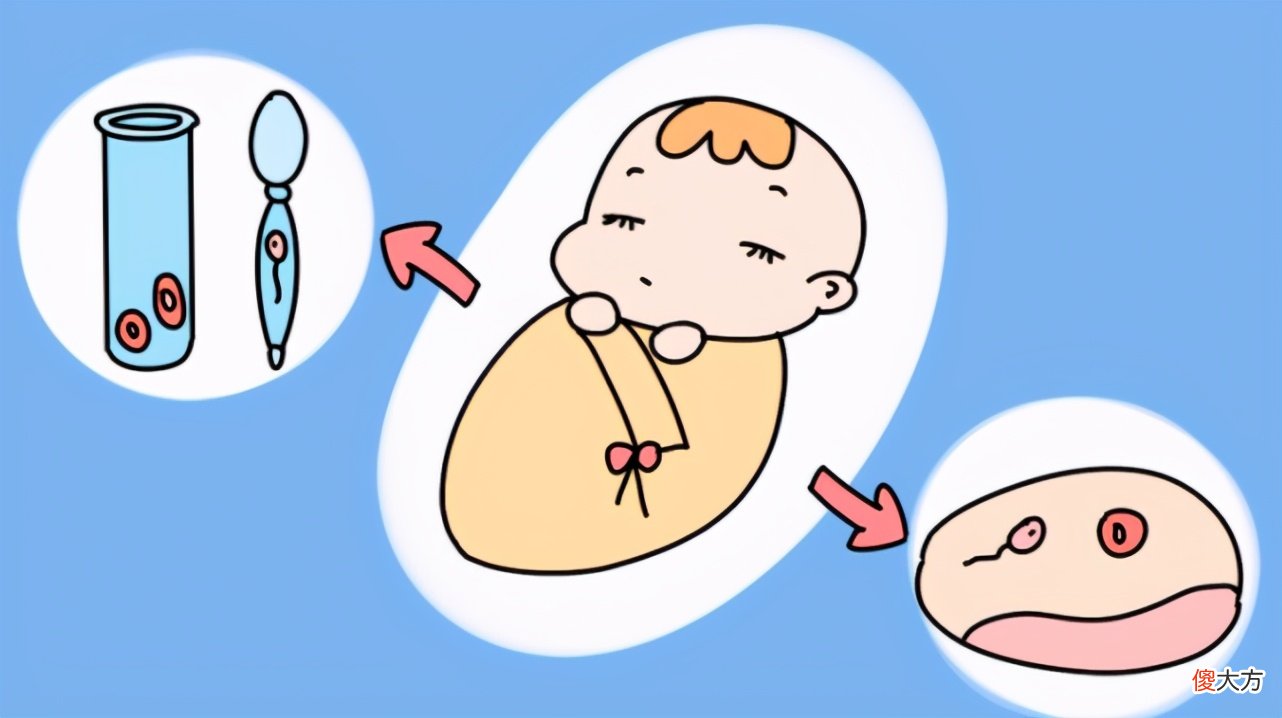 取卵后会肚子疼吗 取卵后肚子会痛吗