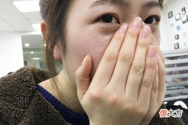 叶酸有什么作用 叶酸有什么作用和功效