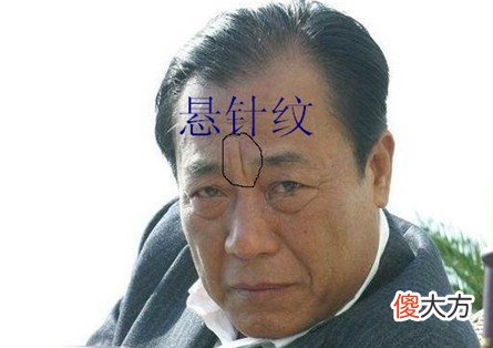 额头有皱纹,脑门皱纹