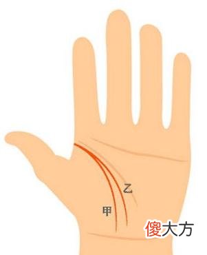 两条生命线图解