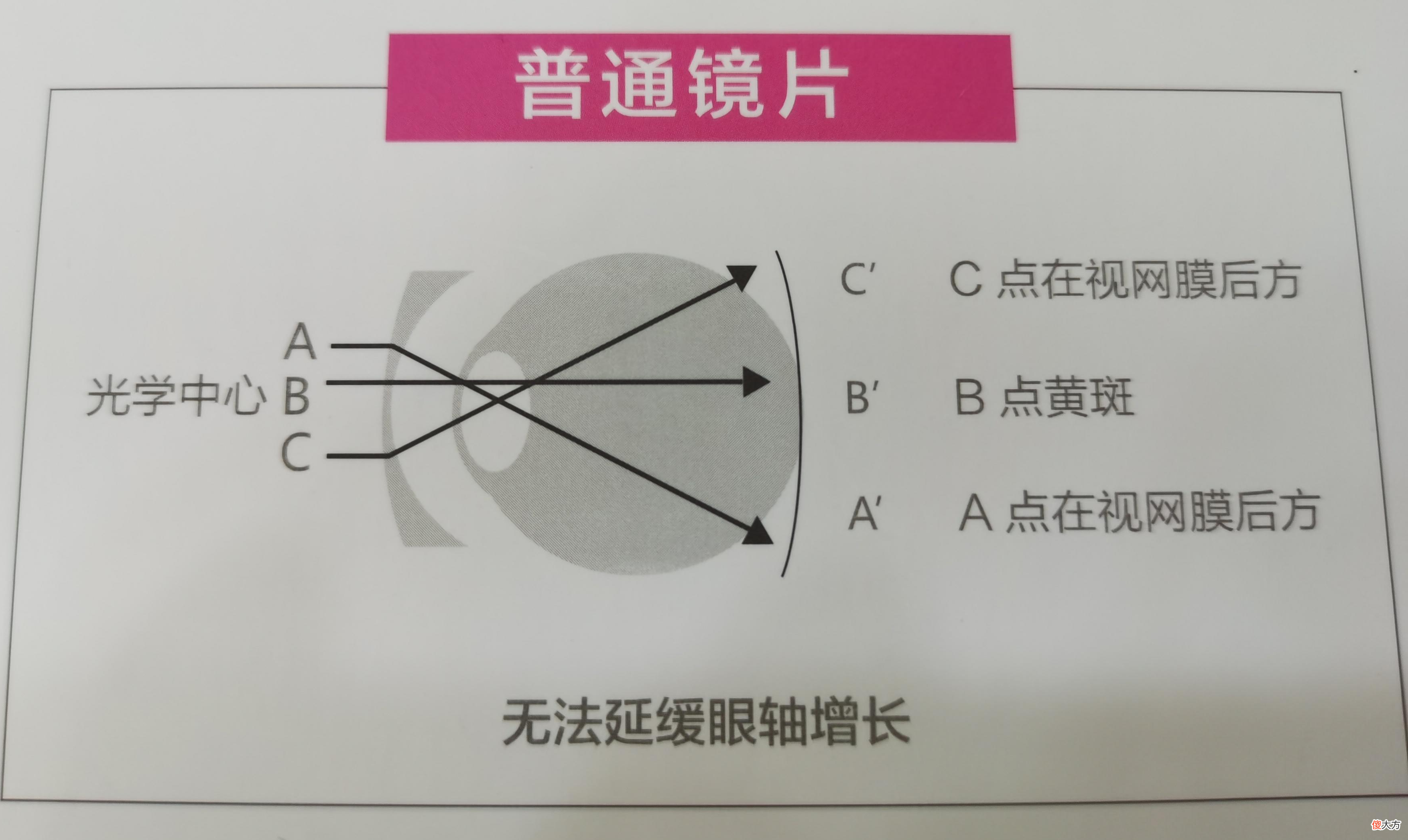 配眼镜商家推荐的多功能镜片真的有用吗 眼镜店可以配一个眼镜片吗