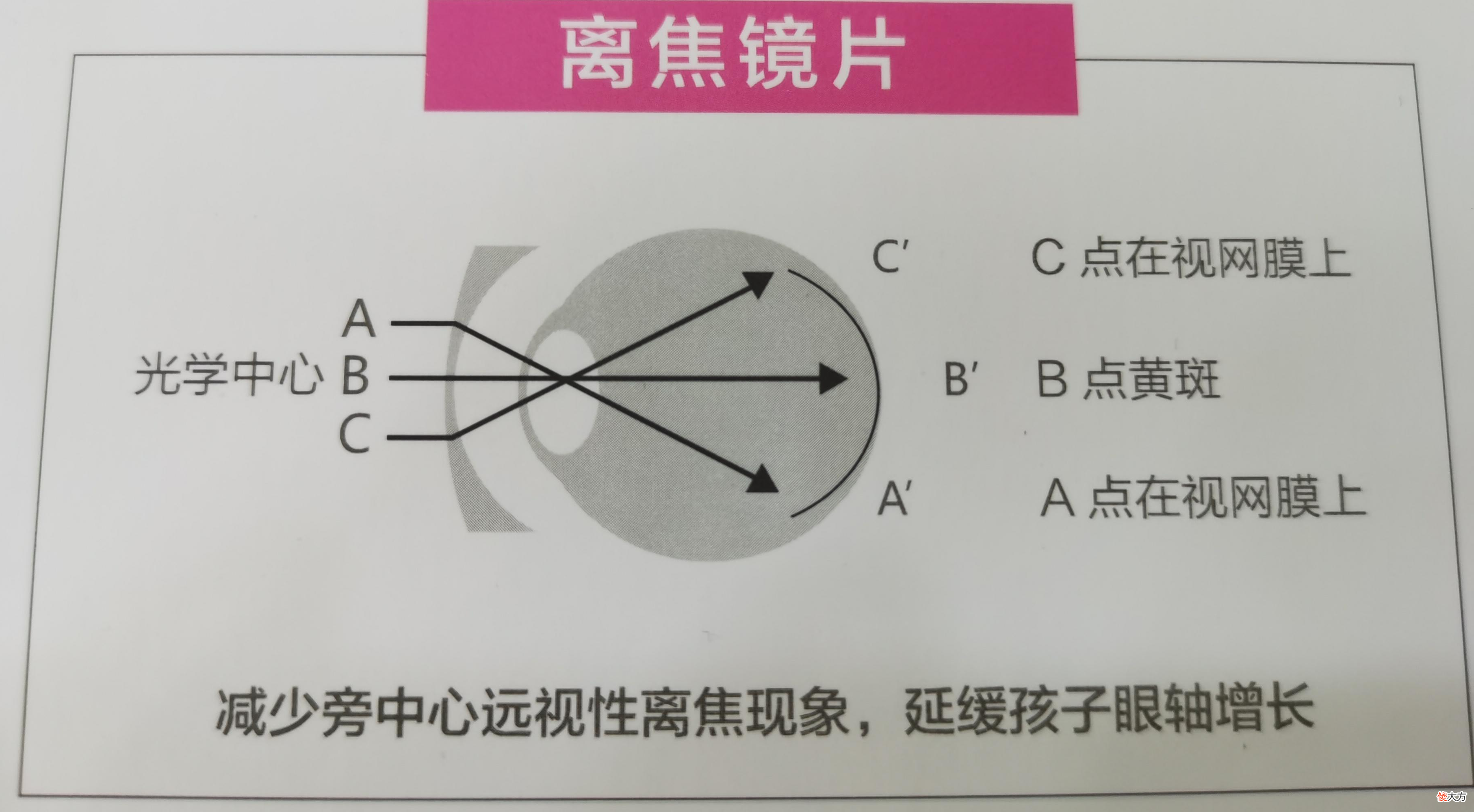配眼镜商家推荐的多功能镜片真的有用吗 眼镜店可以配一个眼镜片吗