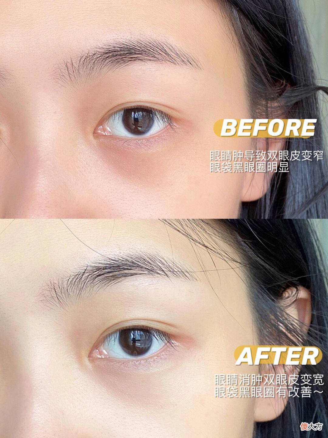 这些问题护肤品能解决吗 护肤品解决什么问题