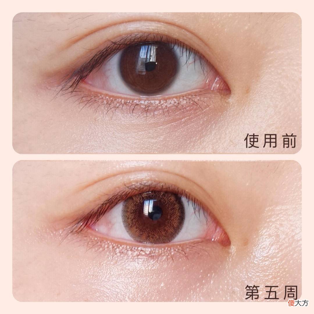 这些问题护肤品能解决吗 护肤品解决什么问题