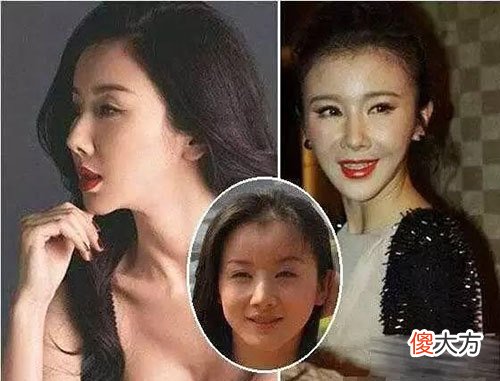 那些一刀切削骨的明星还好吗 哪个明星削骨了