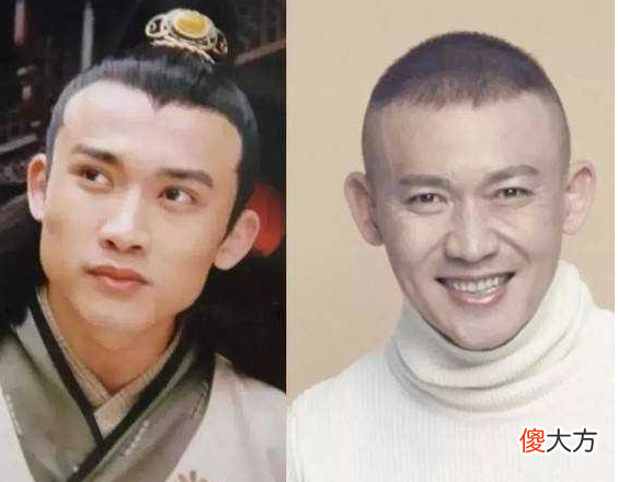 那些为此削骨而留下后遗症的明星们后悔了吗 整容削骨的后遗症