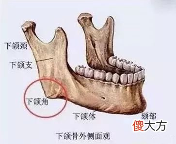 那些为此削骨而留下后遗症的明星们后悔了吗 整容削骨的后遗症
