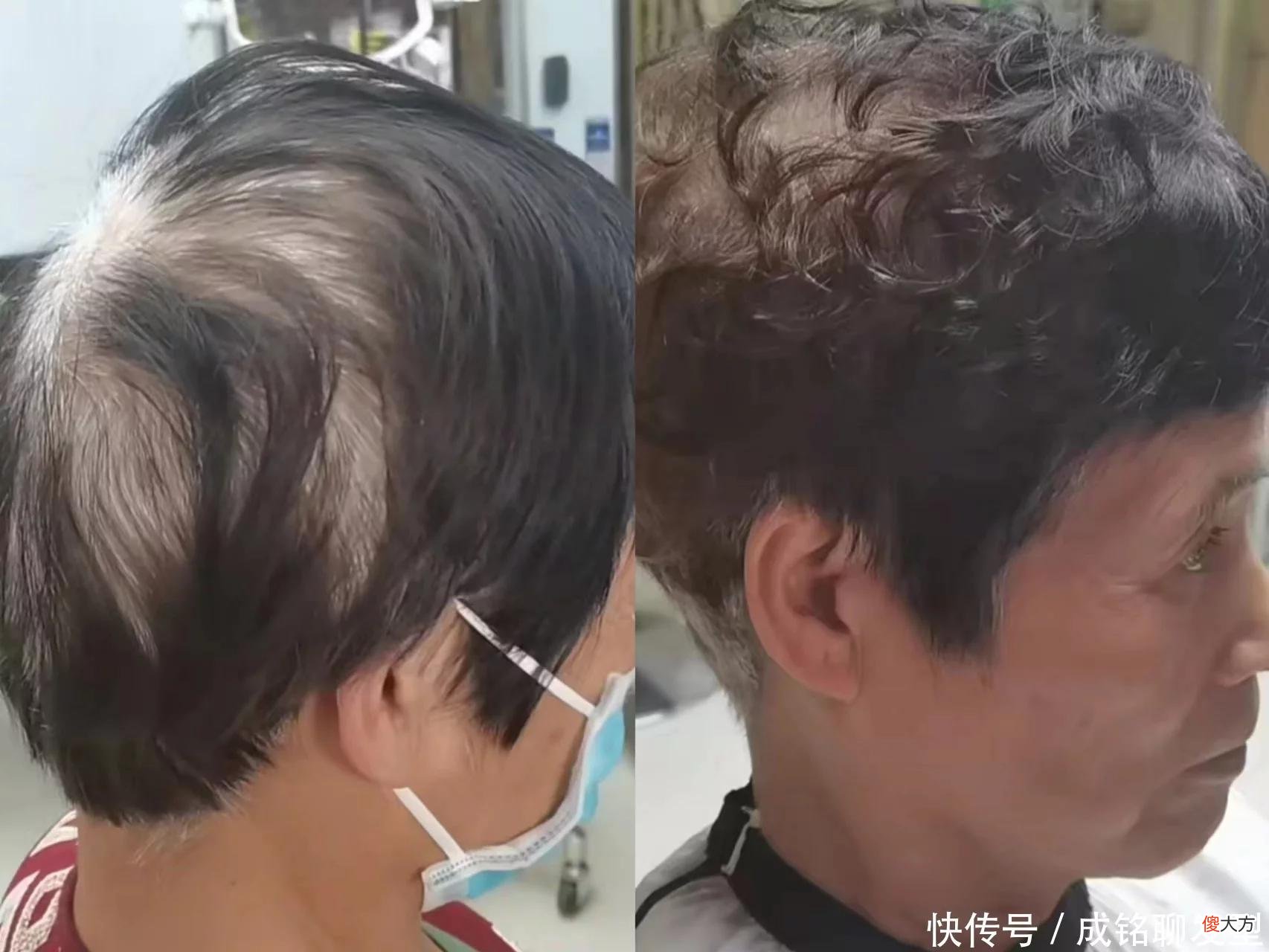 【就爱时尚】老人白发多发量少，试试这款冷烫小卷发型，不伤发好打理又显发量