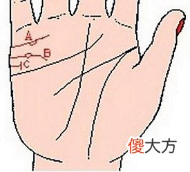 婚姻线上有岛纹表示什么？