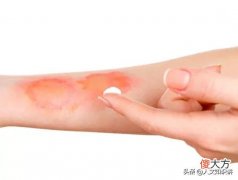 牙膏不单单只是清洁口腔大功臣，还是我们日常生活中的小帮手
