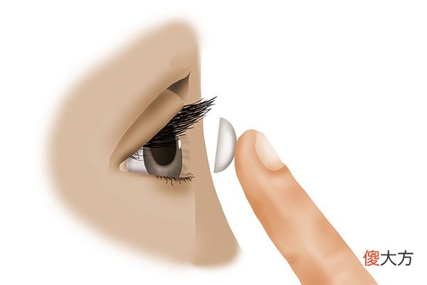 激光手术和戴隐形眼镜 激光近视手术和隐形眼镜