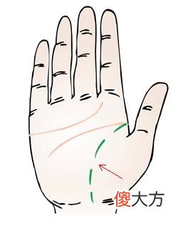 生命线断开图解
