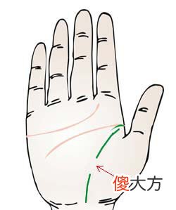 生命线断开图解