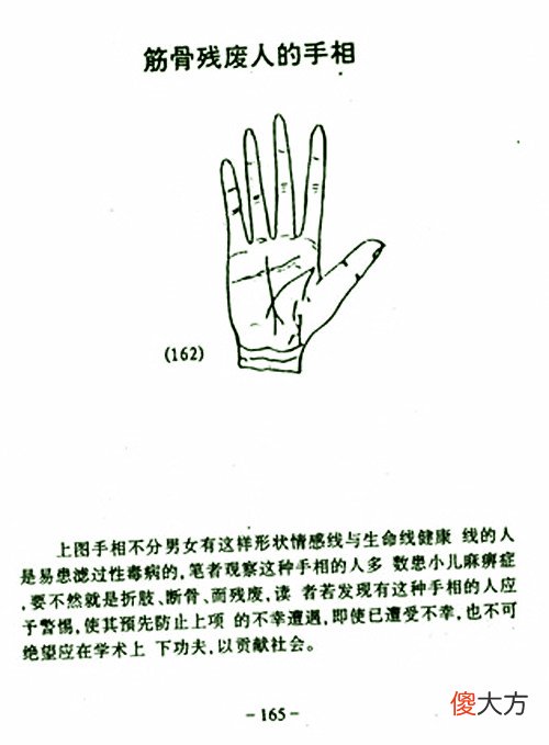 筋骨残废人的手相