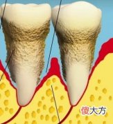 喝黑咖啡的会伤牙吗 喝黑咖啡会对牙齿不好吗