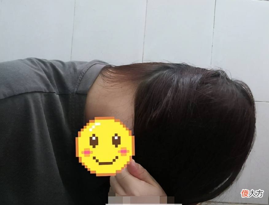 “扁头”最扁能有多夸张,网友晒照不断、花式吐槽太心酸