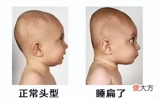 “扁头”最扁能有多夸张,网友晒照不断、花式吐槽太心酸