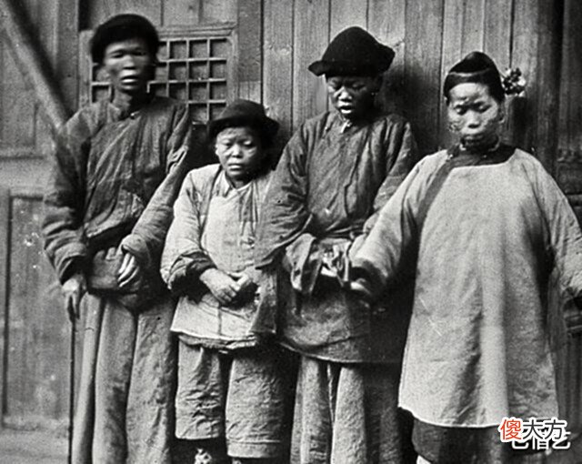 【爱历史】晚清老照片: 旗人福晋明眸皓齿亭亭玉立, 男子患麻风病脸如猪头!