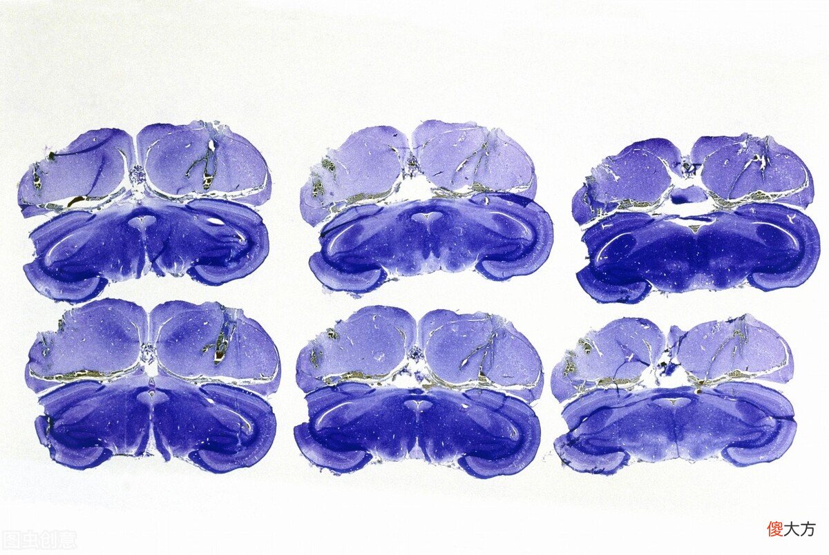 我们的大脑开发了多少 人们的大脑开发了多少