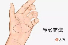 男人手掌有痣好不好