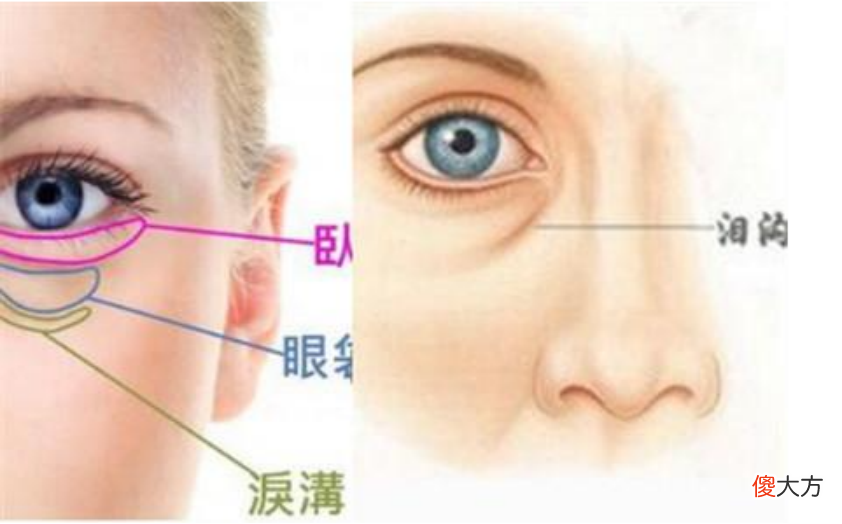 为什么别人没有眼袋 为什么有些人没有眼袋