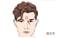 额头有痣代表什么图解