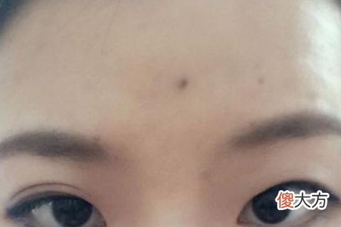 额头上有疤的女人好吗