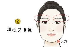 克夫痣在哪里