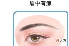 右眉毛上有痣好不好