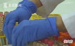 澳大利亚研究发现与儿童新冠肺炎重症相关蛋白质