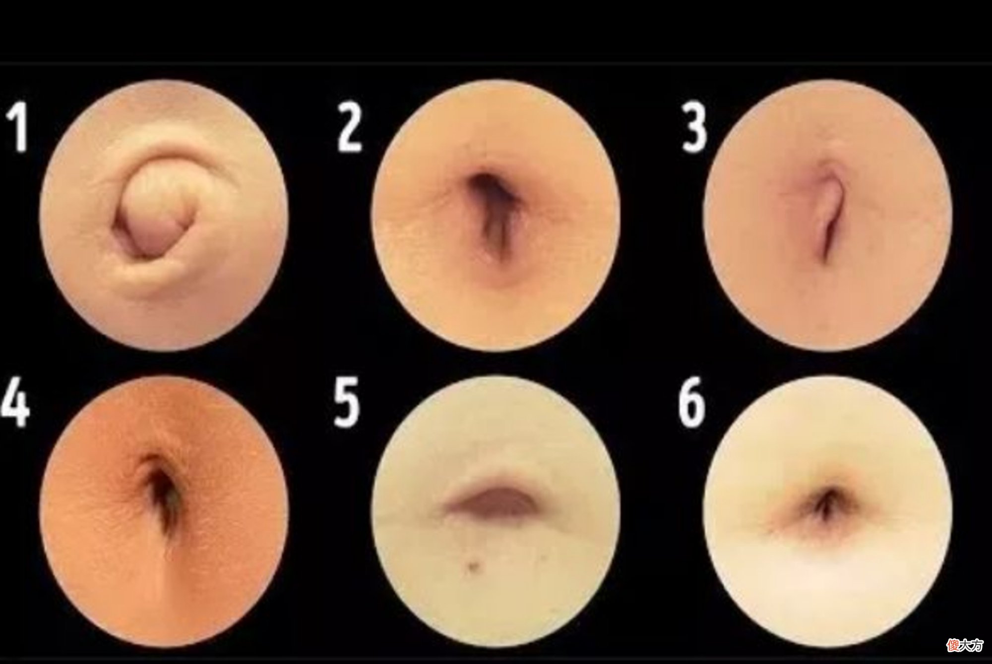 宝宝肚脐眼的“泥”又黑又脏，宝妈千万别乱扣，五步教你科学清理