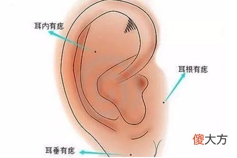 耳朵前面有痣好不好