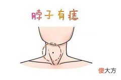 脖子有痣的说法大全