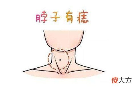 脖子有痣的说法大全