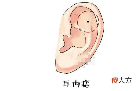 耳朵上有痣请问代表什么