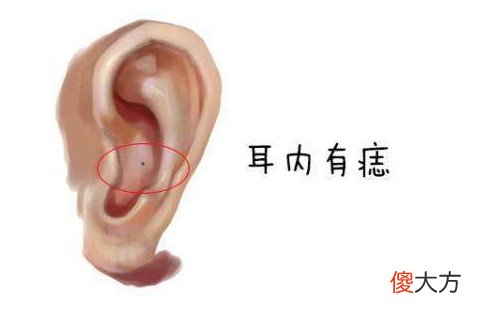 耳朵上有三颗富贵痣快看自己有没有