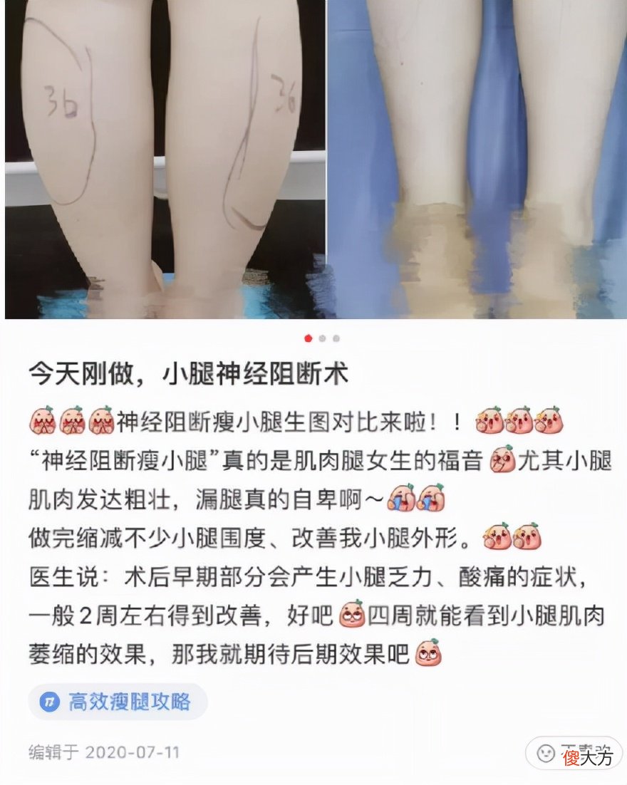 被容貌焦虑毁掉的女孩 女孩遭遇毁容