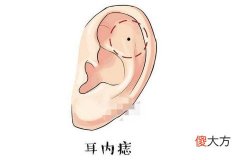 图解男人耳朵上有痣