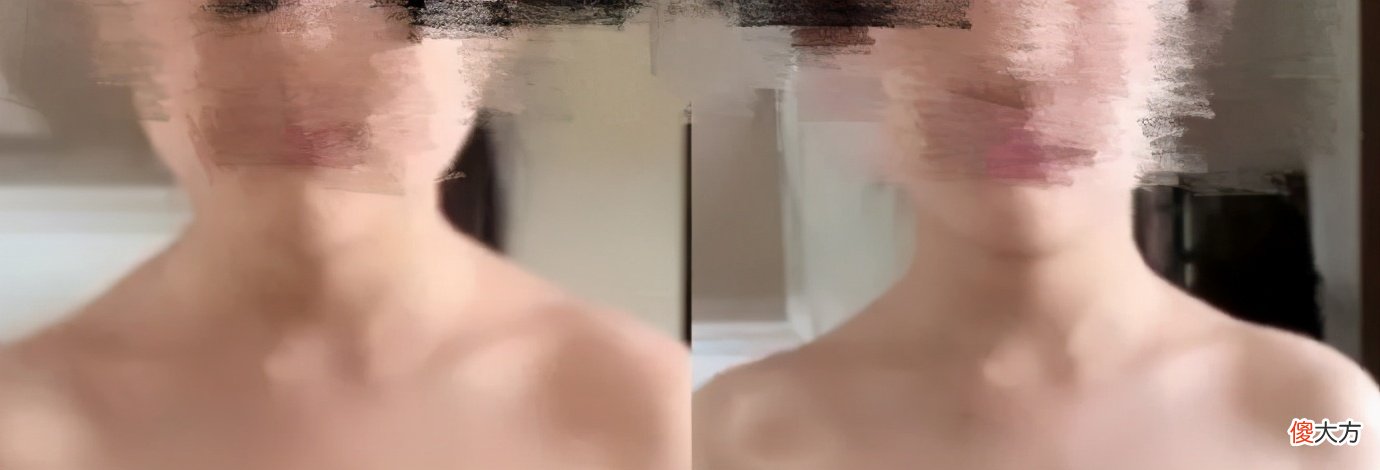 你的斜方肌还好吗 斜方肌不好看吗