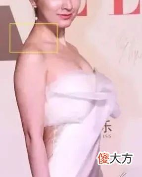 你的斜方肌还好吗 斜方肌不好看吗