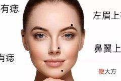女生脸上开运痣长在哪里