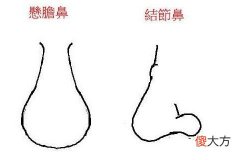 鼻梁低的人命运怎样