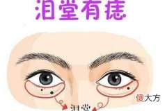 哪里长痣的女人不能娶