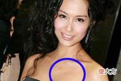 女性胸上不同位置长痣代表什么