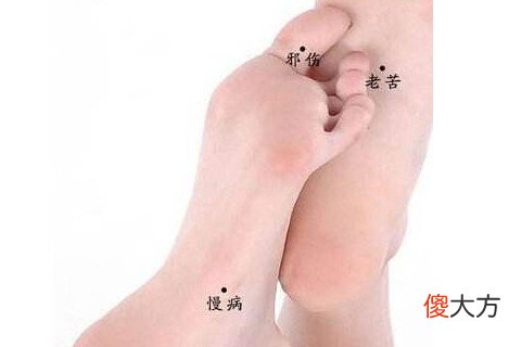 女人身上最有钱的痣在哪里