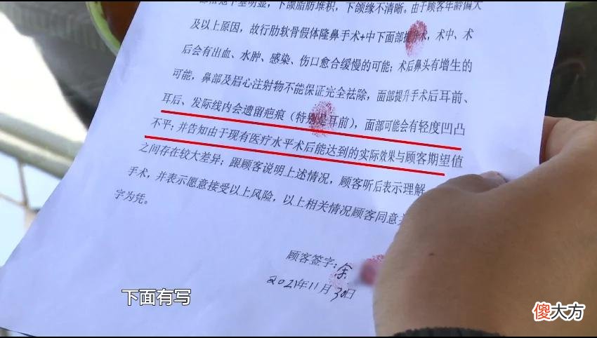 【时尚一点】51岁大姐拉皮又隆鼻，期盼变成活招牌！结果惨了