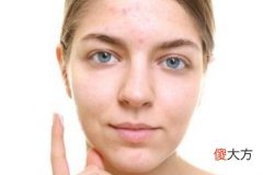 额头有竖纹的女人命运如何