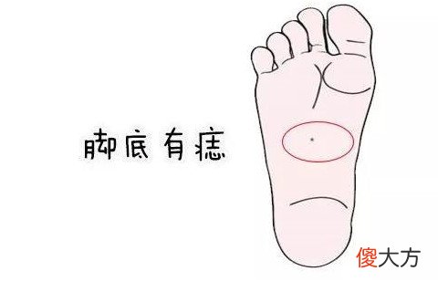 脚底板长痣的痣相图解